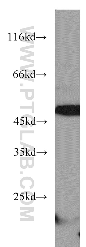 Western Blot (WB) analysis of mouse heart tissue using ANGPTL4 Polyclonal antibody (18374-1-AP)