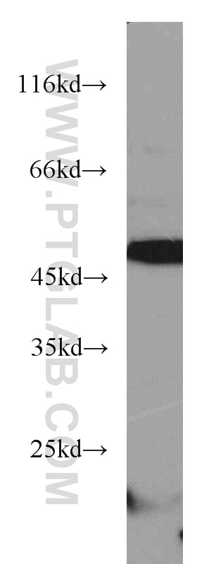 WB analysis of mouse heart using 18374-1-AP