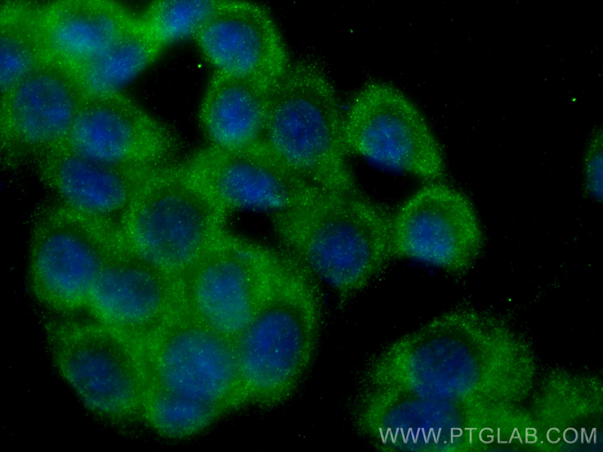 IF Staining of HT-29 using 31497-1-AP Immunofluorescence (IF) / fluorescent staining of HT-29 cells using ANGPTL4 Polyclonal antibody (31497-1-AP)