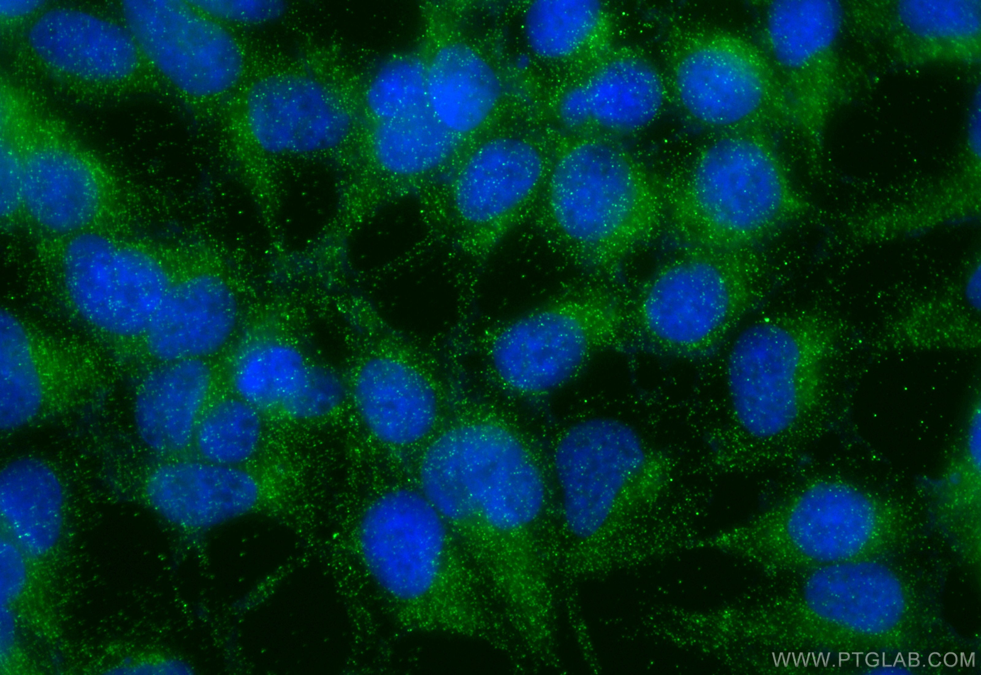 IF Staining of HEK-293 using 31497-1-AP Immunofluorescence (IF) / fluorescent staining of HEK-293 cells using ANGPTL4 Polyclonal antibody (31497-1-AP)