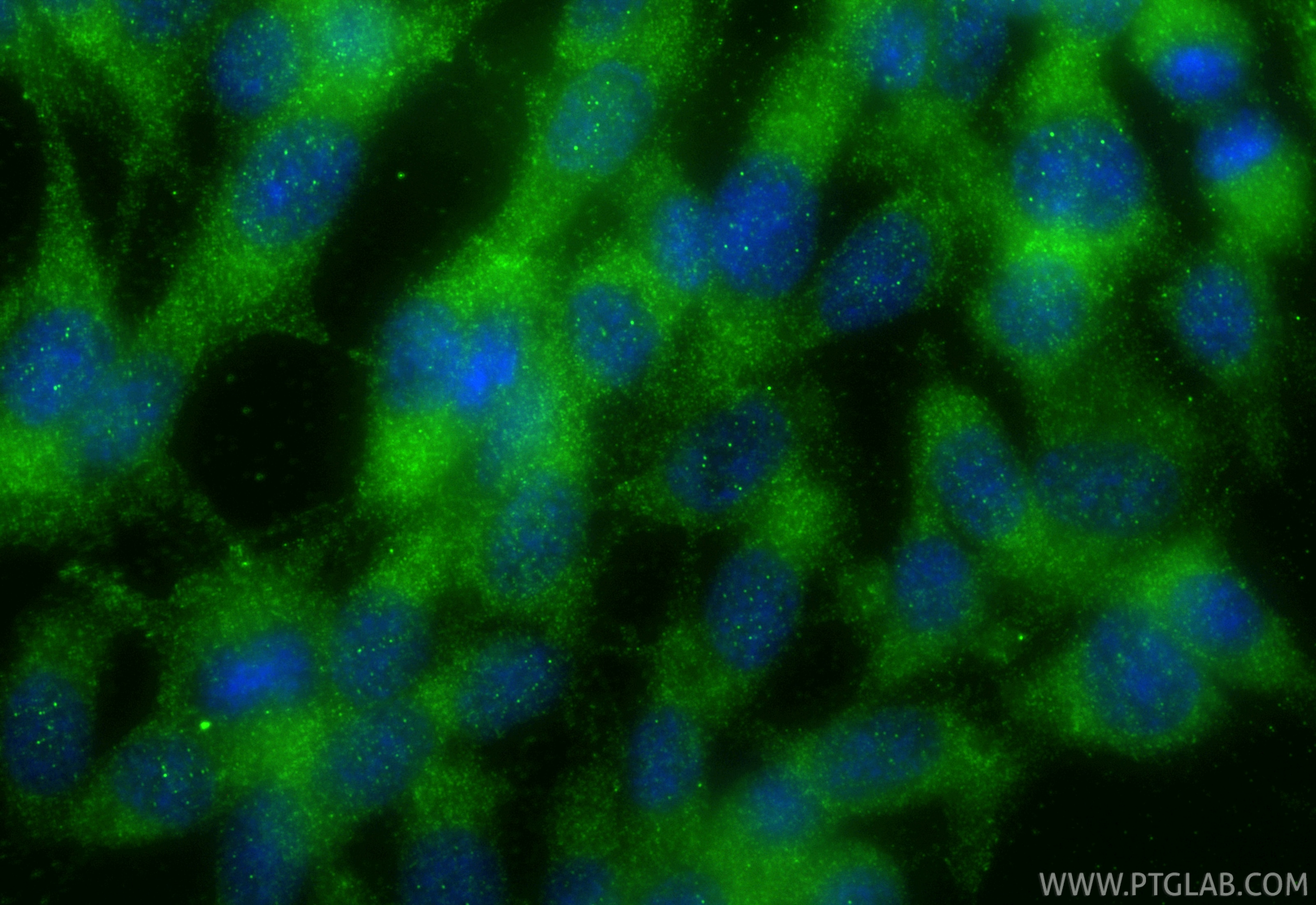 IF Staining of NIH/3T3 using 31497-1-AP Immunofluorescence (IF) / fluorescent staining of NIH/3T3 cells using ANGPTL4 Polyclonal antibody (31497-1-AP)