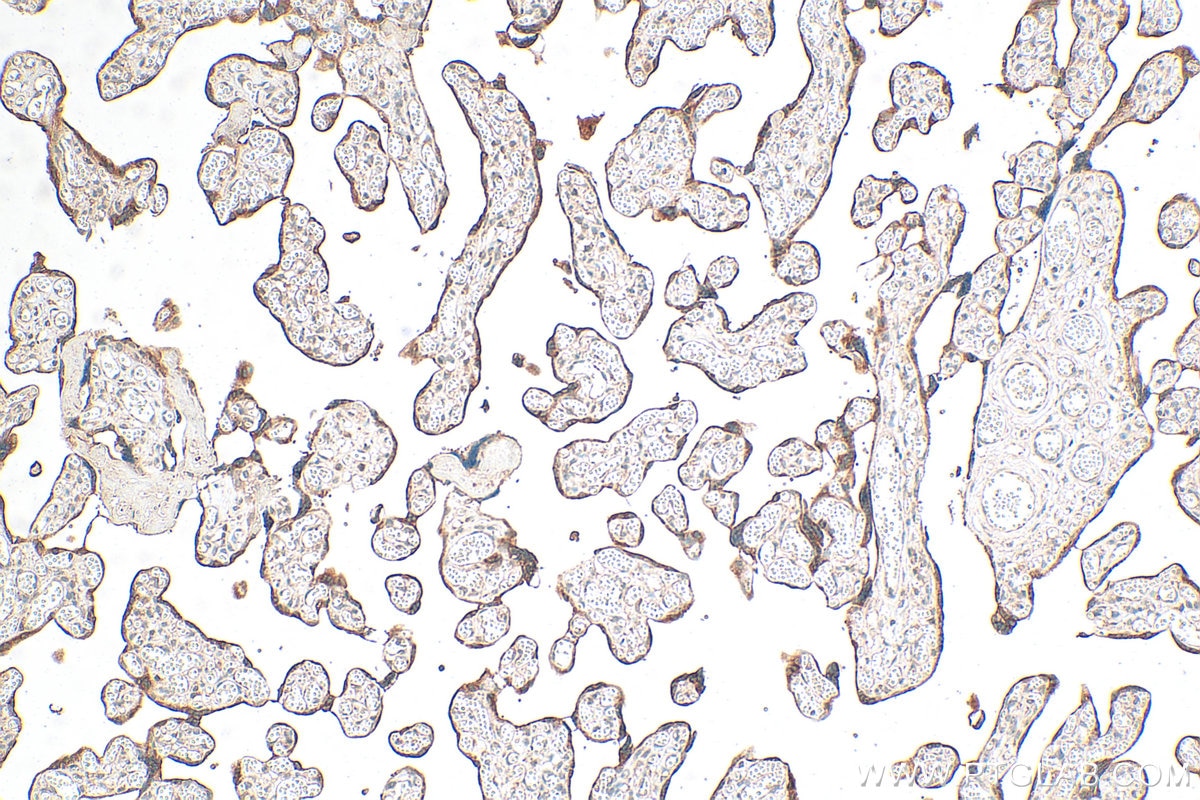 IHC staining of human placenta using 31497-1-AP Immunohistochemistry (IHC) staining of human placenta tissue using ANGPTL4 Polyclonal antibody (31497-1-AP)