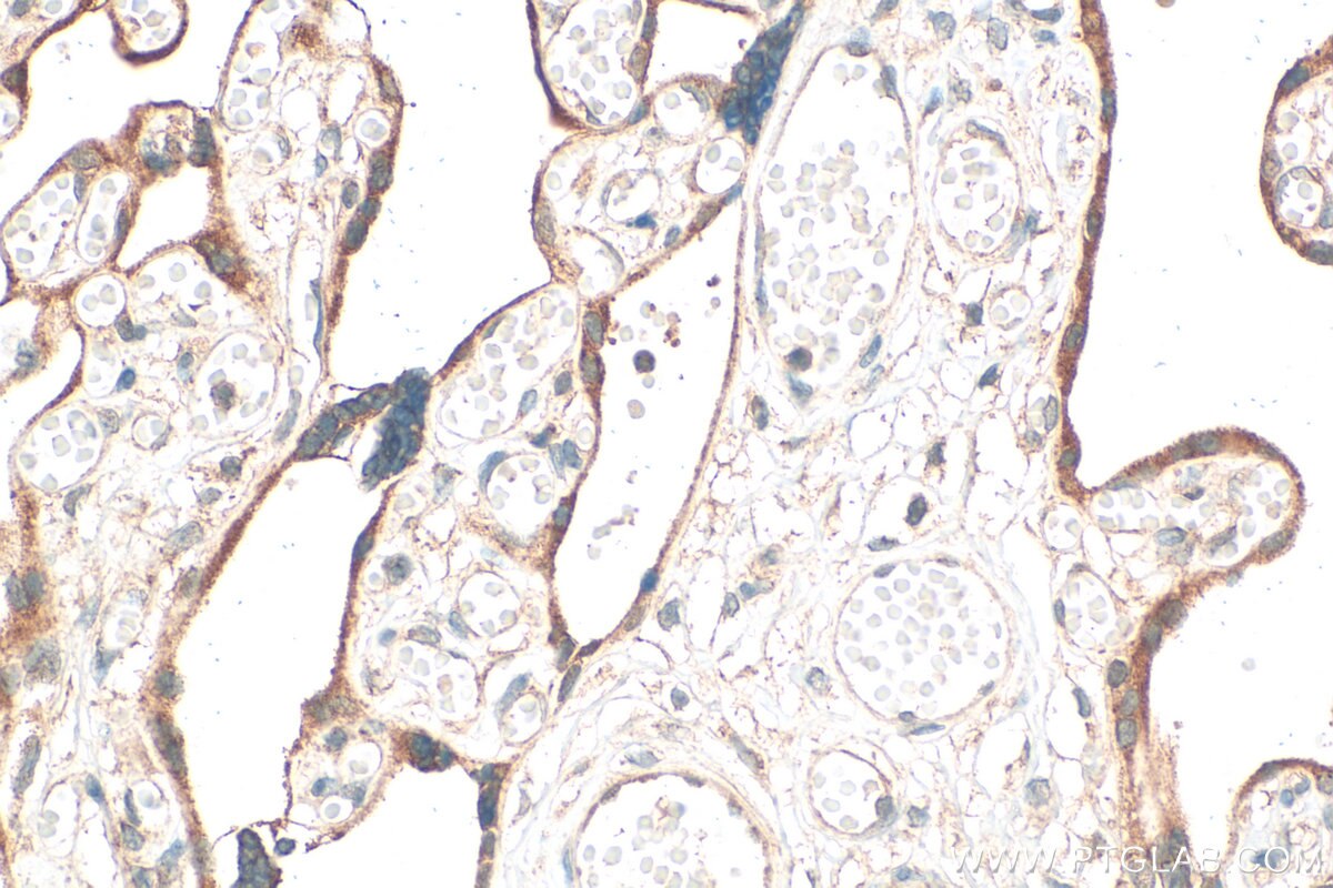 IHC staining of human placenta using 31497-1-AP Immunohistochemistry (IHC) staining of human placenta tissue using ANGPTL4 Polyclonal antibody (31497-1-AP)