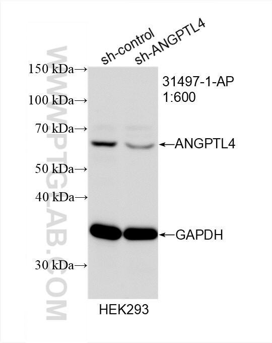WB analysis of HEK-293 using 31497-1-AP Western Blot (WB) analysis of HEK-293 cells using ANGPTL4 Polyclonal antibody (31497-1-AP)