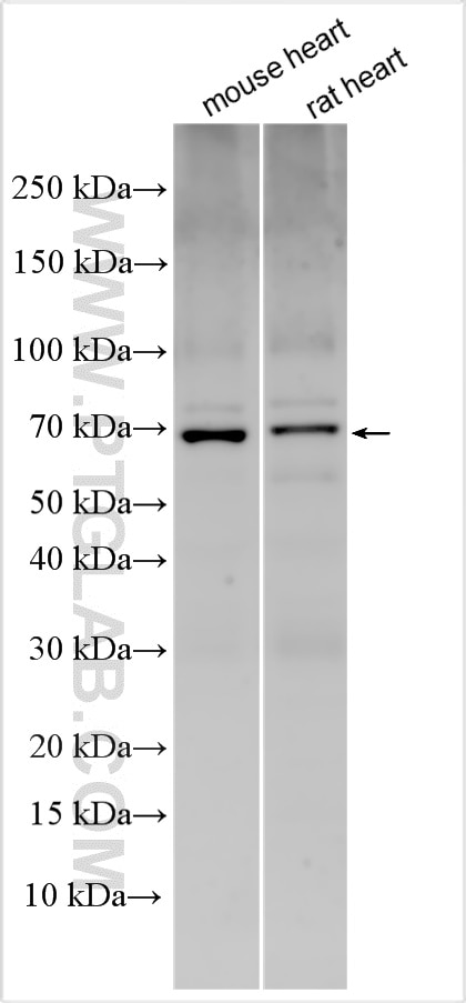 WB analysis using 31497-1-AP Western Blot (WB) analysis of various lysates using ANGPTL4 Polyclonal antibody (31497-1-AP)