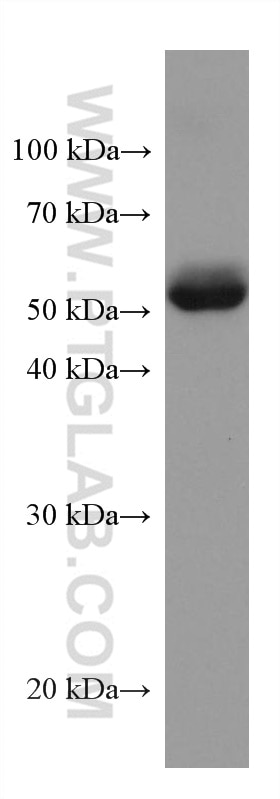 Western Blot (WB) analysis of human placenta tissue using ANGPTL4 Monoclonal antibody (67577-1-Ig)