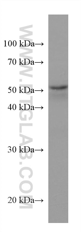 Western Blot (WB) analysis of A549 cells using ANGPTL4 Monoclonal antibody (67577-1-Ig)