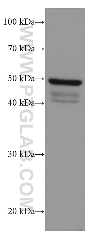 Western Blot (WB) analysis of COLO 320 cells using ANGPTL4 Monoclonal antibody (67577-1-Ig)