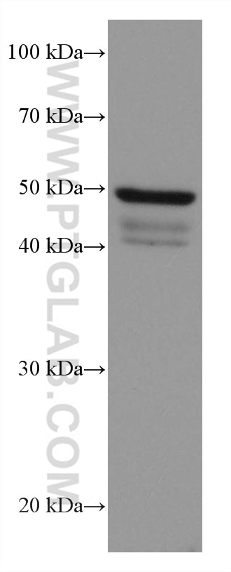 WB analysis of COLO 320 using 67577-1-Ig