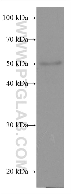 Western Blot (WB) analysis of mouse brain tissue using ANGPTL4 Monoclonal antibody (67577-1-Ig)