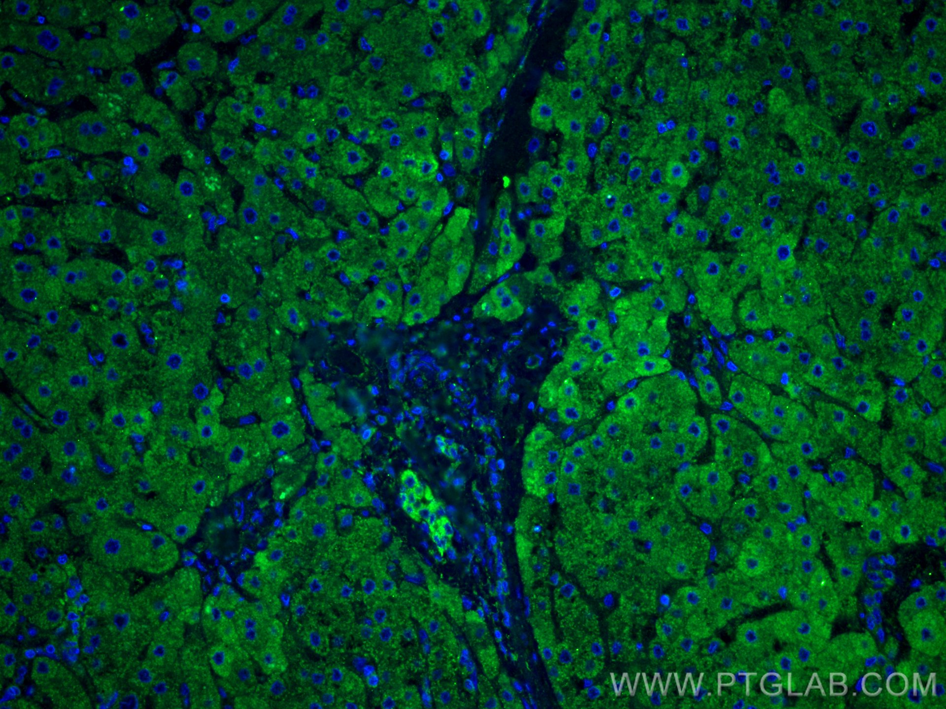 Immunofluorescence (IF) / fluorescent staining of human liver tissue using ANGPTL8/Betatrophin Monoclonal antibody (66641-1-Ig)