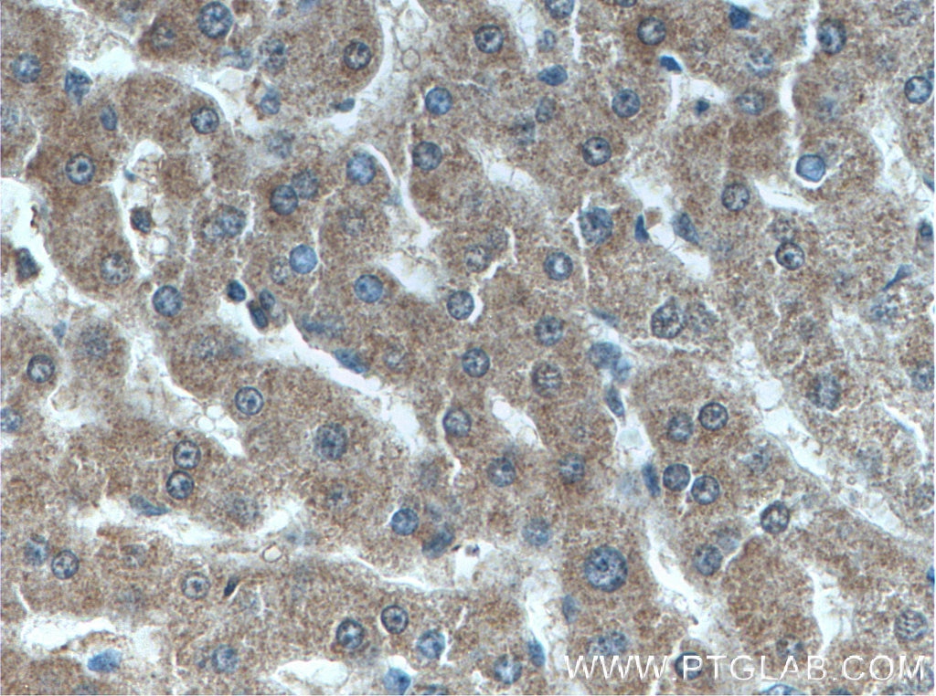 Immunohistochemistry (IHC) staining of human liver tissue using ANGPTL8/Betatrophin Monoclonal antibody (66641-1-Ig)