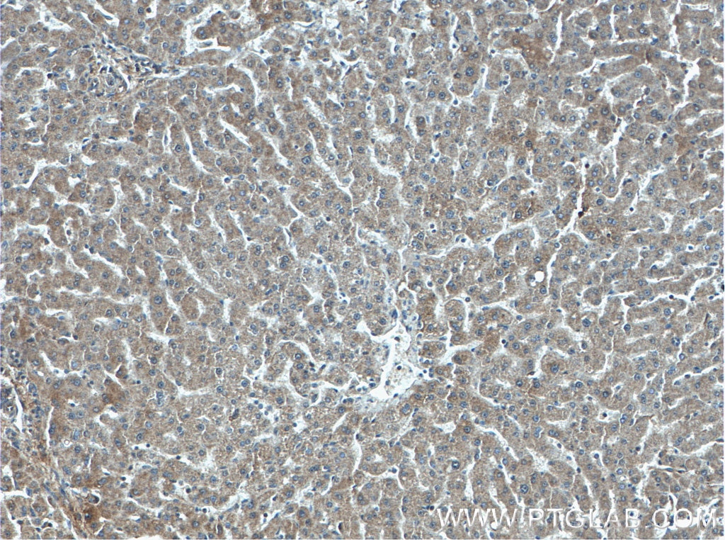 Immunohistochemistry (IHC) staining of human liver tissue using ANGPTL8/Betatrophin Monoclonal antibody (66641-1-Ig)
