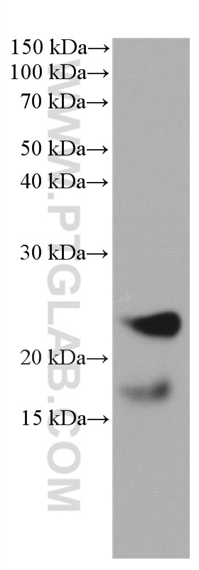 ANGPTL8/Betatrophin