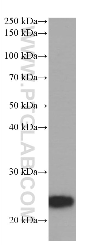 Western Blot (WB) analysis of human adipose tissue using ANGPTL8/Betatrophin Monoclonal antibody (66641-1-Ig)