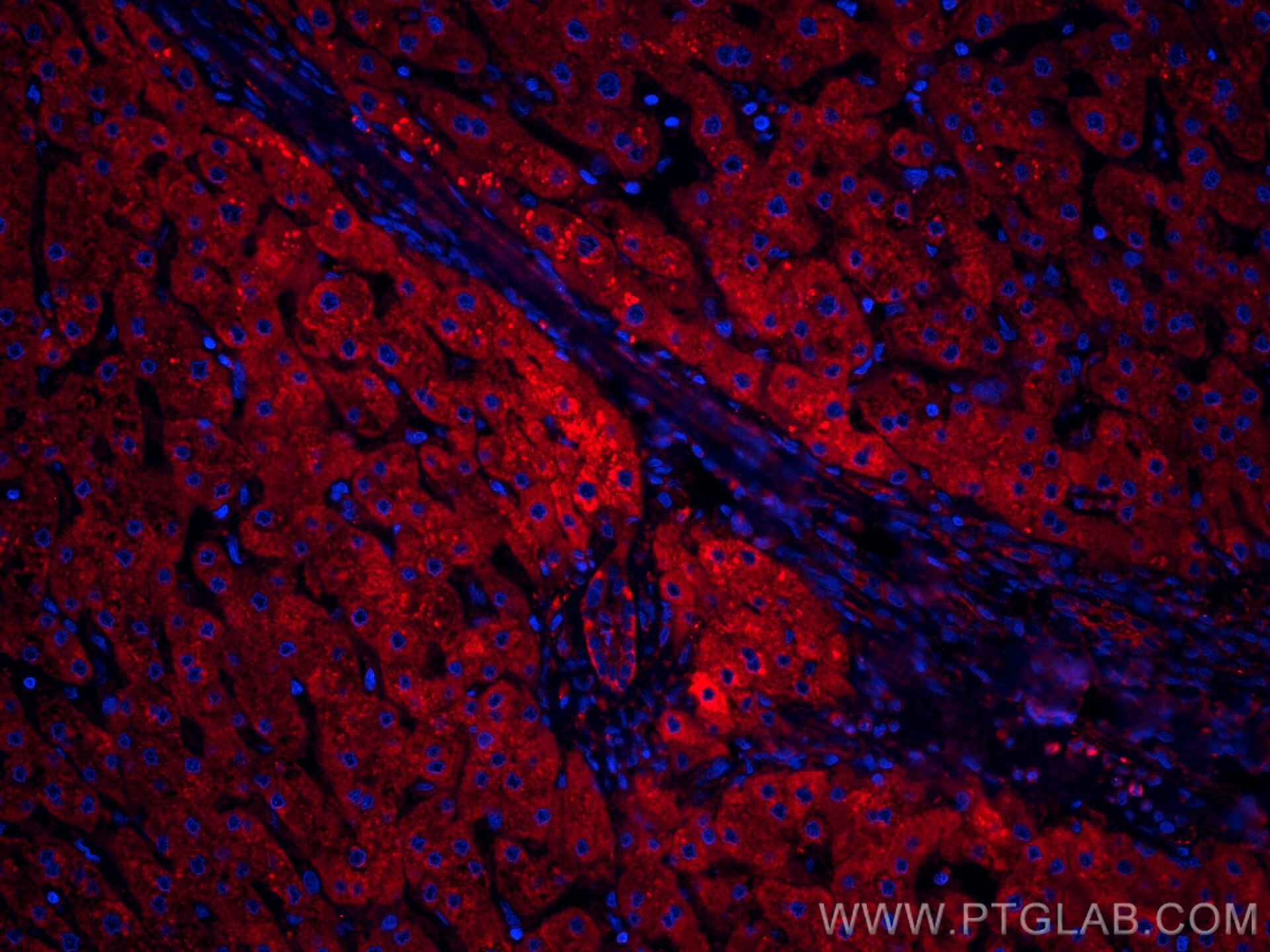 Immunofluorescence (IF) / fluorescent staining of human liver tissue using CoraLite®594-conjugated ANGPTL8 Monoclonal antibod (CL594-66641)