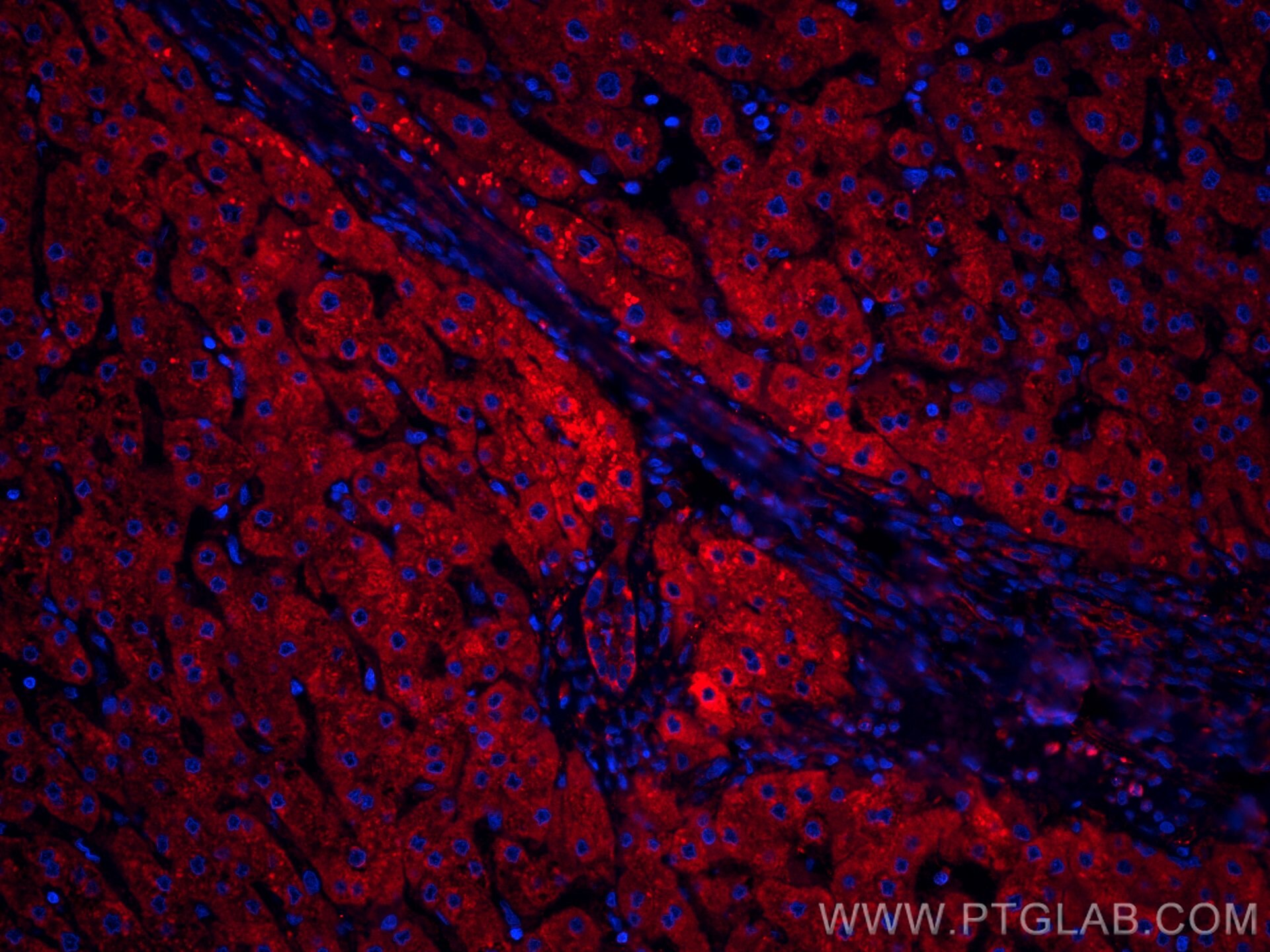 IF Staining of human liver using CL594-66641