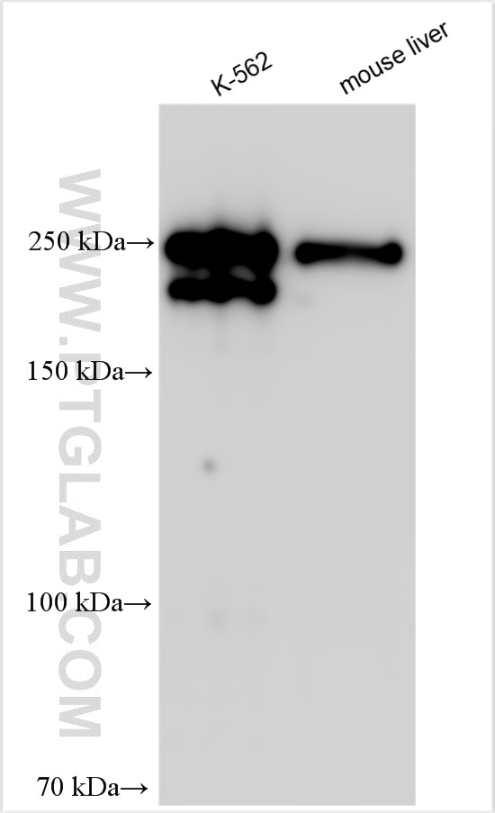 Western Blot (WB) analysis of various lysates using ANK1 Polyclonal antibody (23938-1-AP)