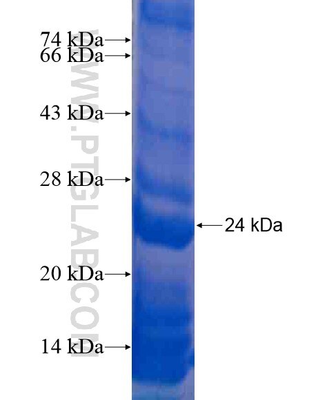ANK1 fusion protein Ag21041 SDS-PAGE