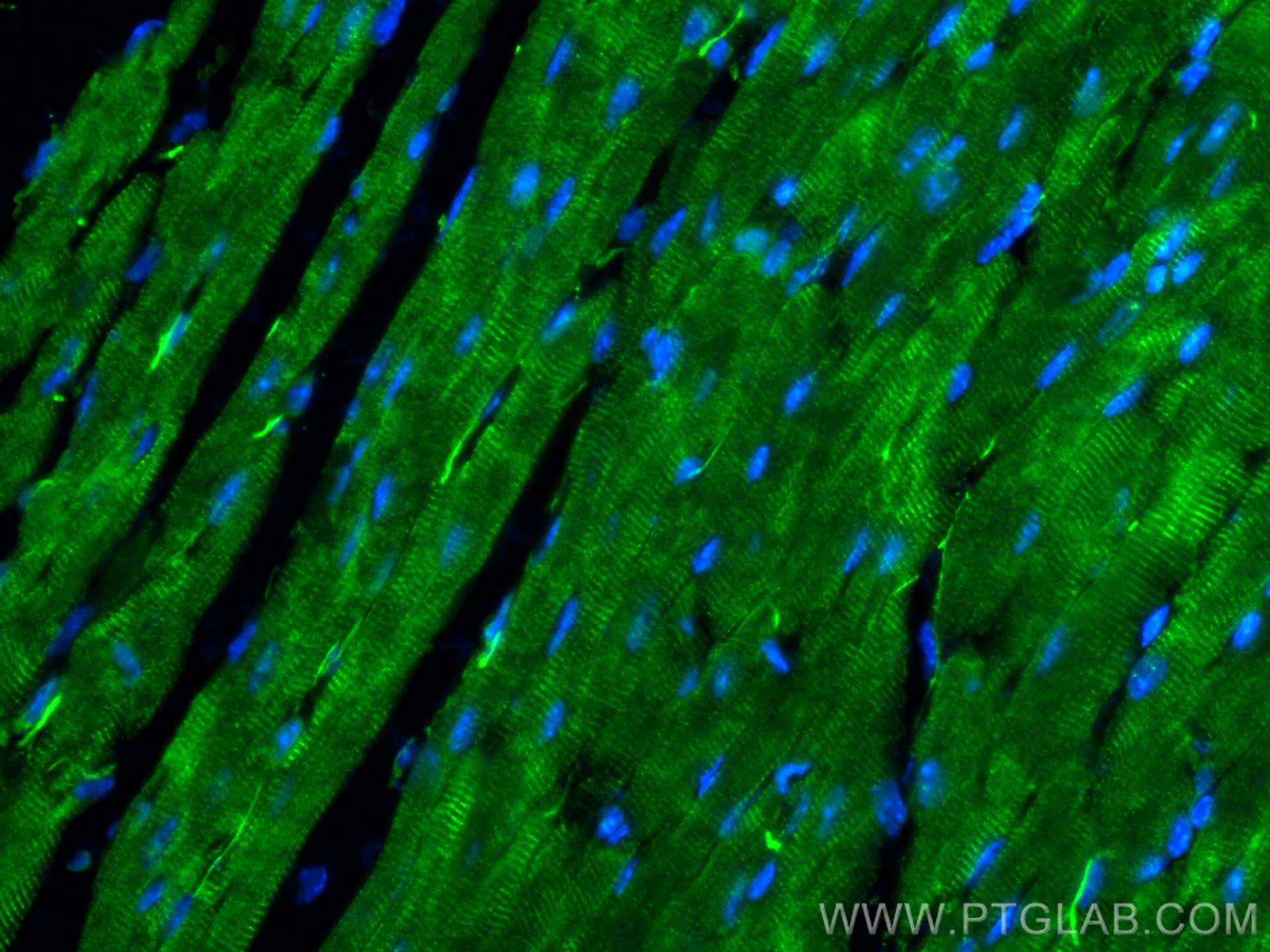 Immunofluorescence (IF) / fluorescent staining of mouse heart tissue using ANK2 Polyclonal antibody (31080-1-AP)