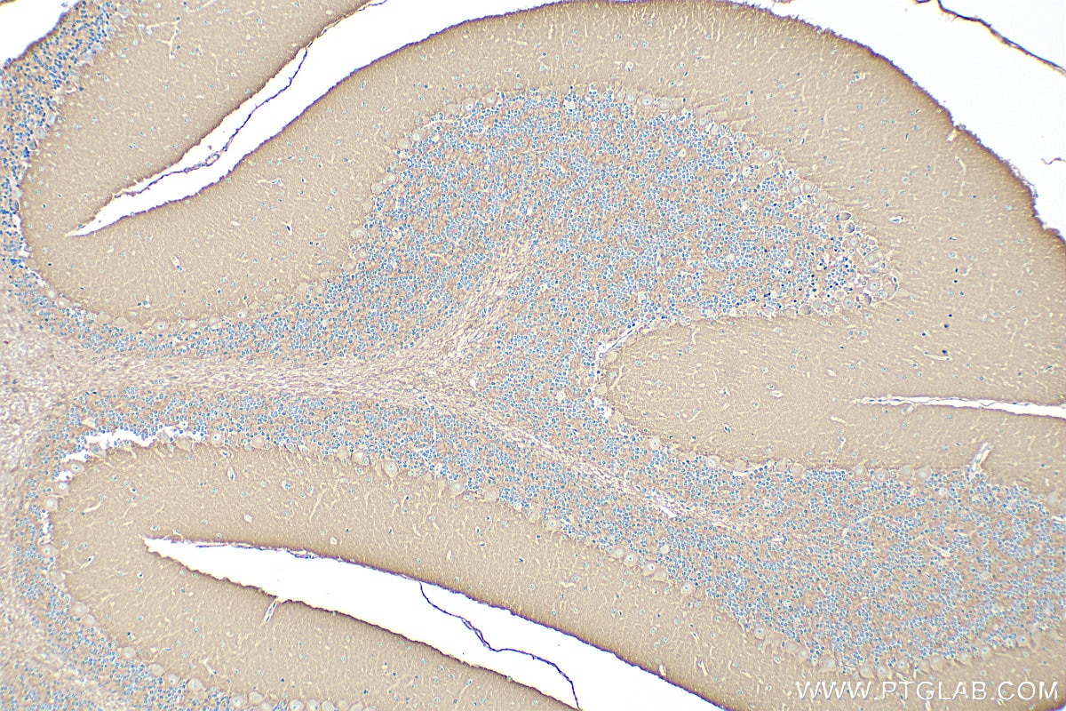 Immunohistochemistry (IHC) staining of mouse cerebellum tissue using ANK2 Polyclonal antibody (31080-1-AP)