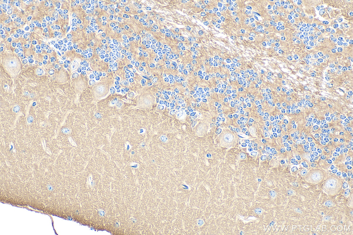 Immunohistochemistry (IHC) staining of mouse cerebellum tissue using ANK2 Polyclonal antibody (31080-1-AP)