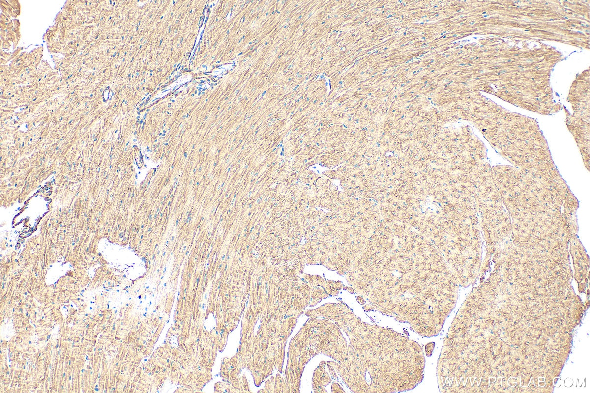 Immunohistochemistry (IHC) staining of mouse heart tissue using ANK2 Polyclonal antibody (31080-1-AP)
