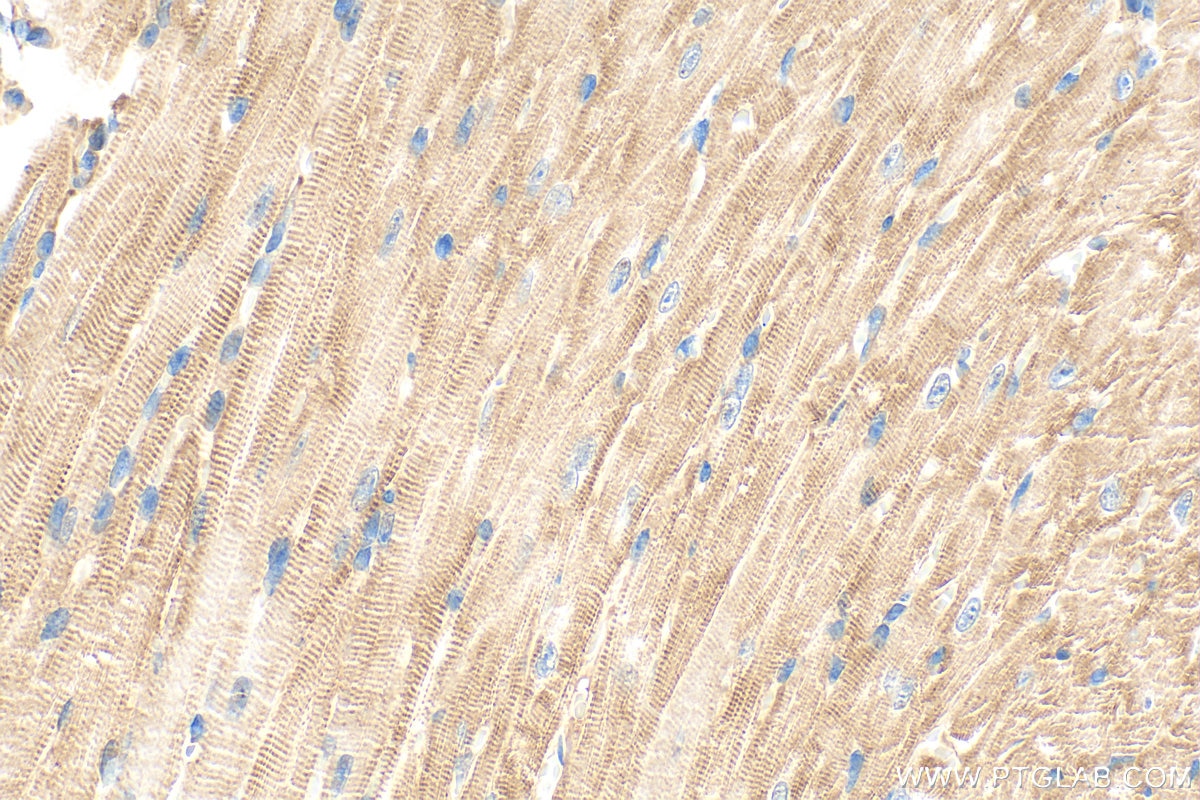 Immunohistochemistry (IHC) staining of mouse heart tissue using ANK2 Polyclonal antibody (31080-1-AP)