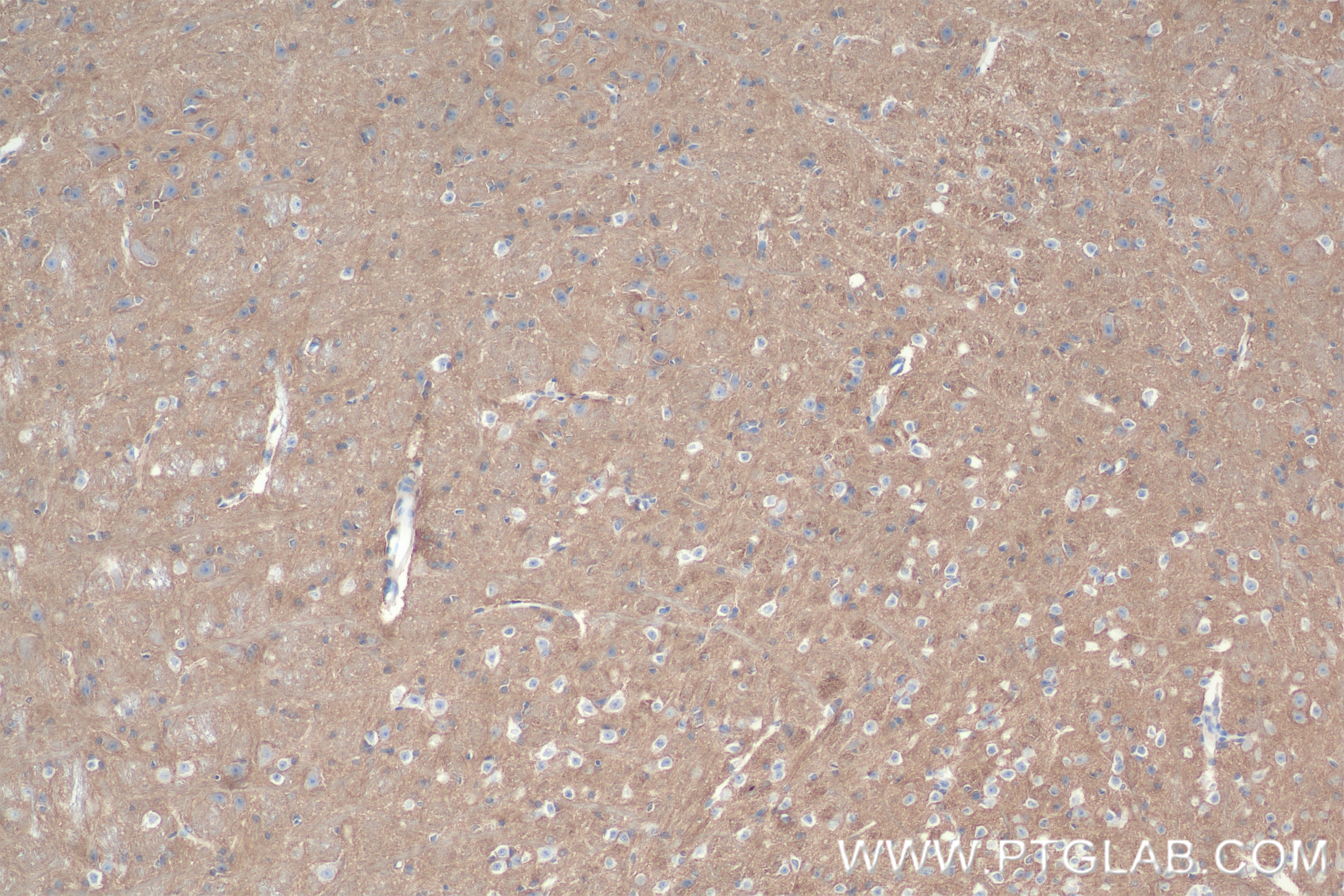 Immunohistochemistry (IHC) staining of mouse cerebellum tissue using ANK2 Recombinant antibody (83912-5-RR)
