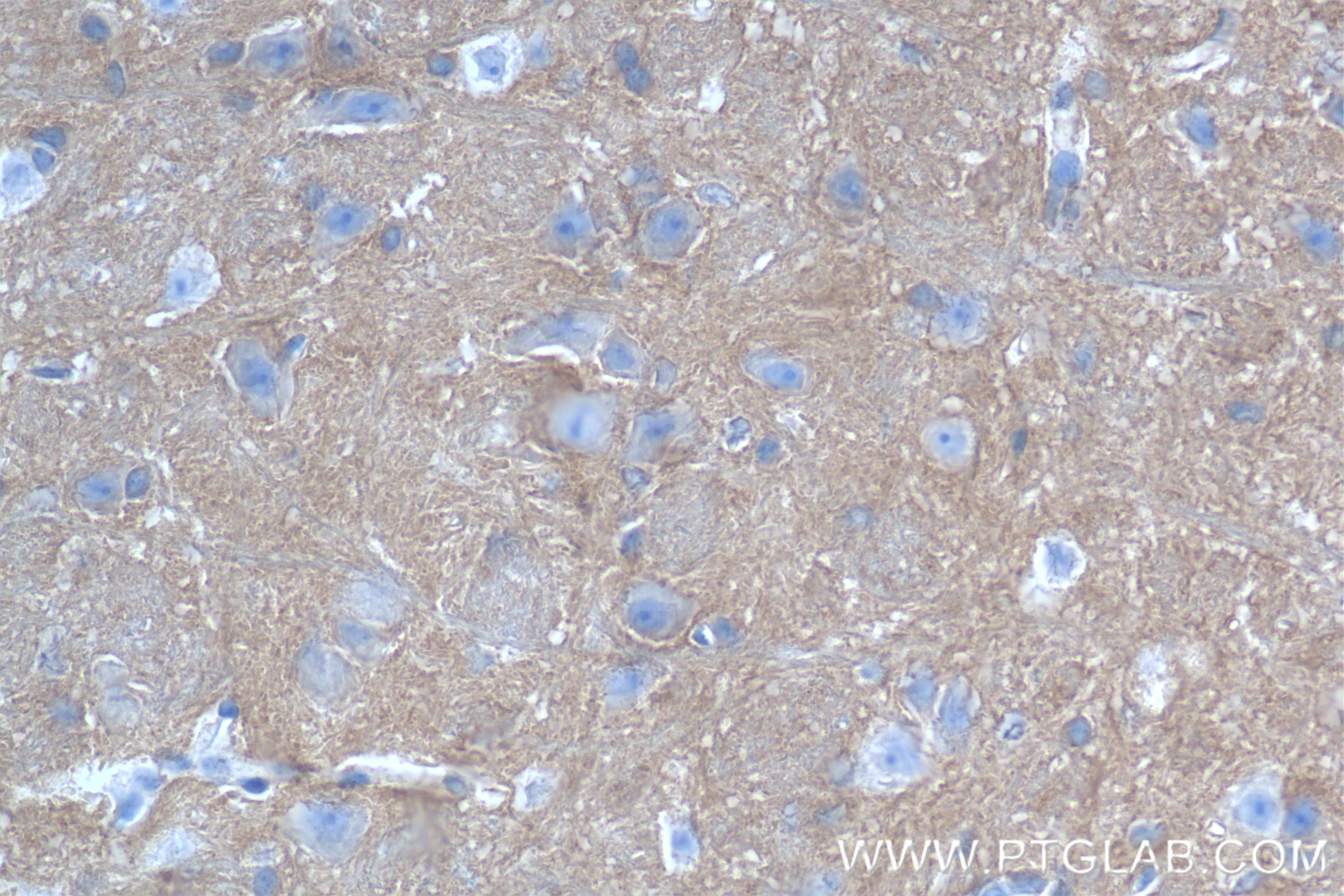 Immunohistochemistry (IHC) staining of mouse cerebellum tissue using ANK2 Recombinant antibody (83912-5-RR)