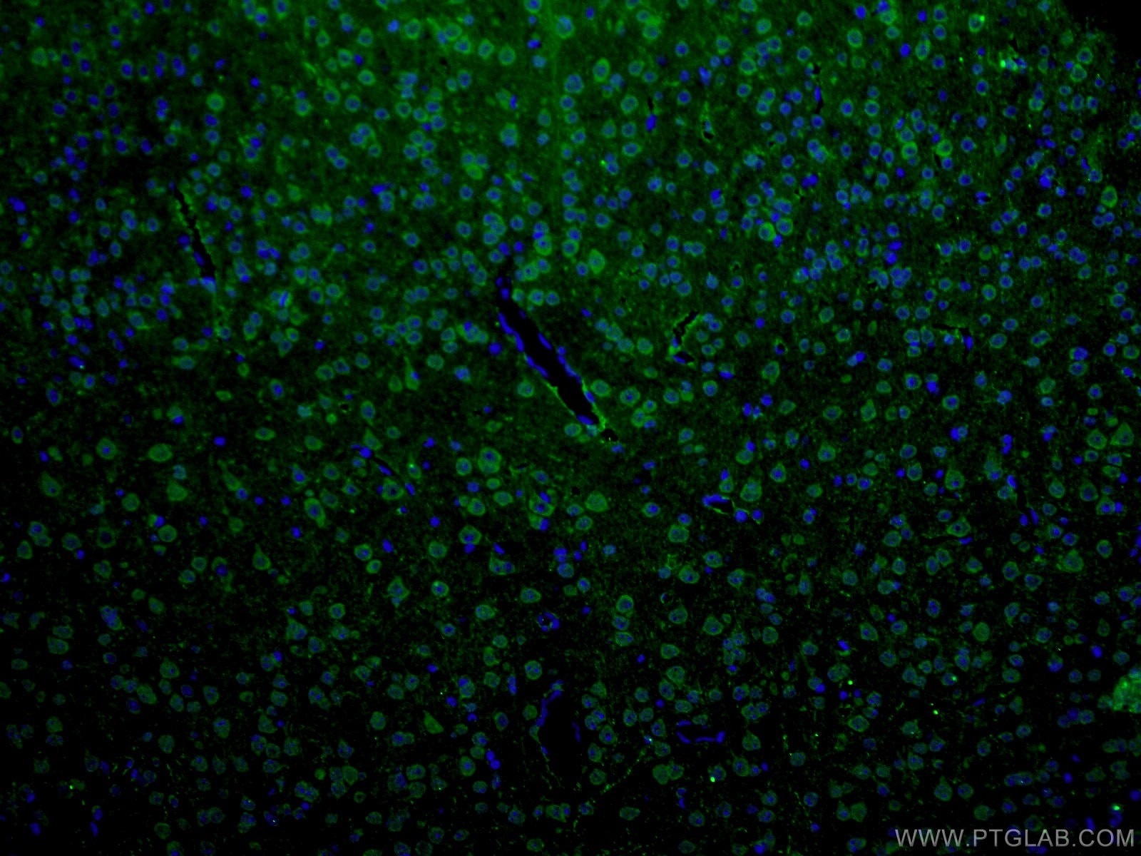 Immunofluorescence (IF) / fluorescent staining of mouse brain tissue using ANK3 Polyclonal antibody (27766-1-AP)