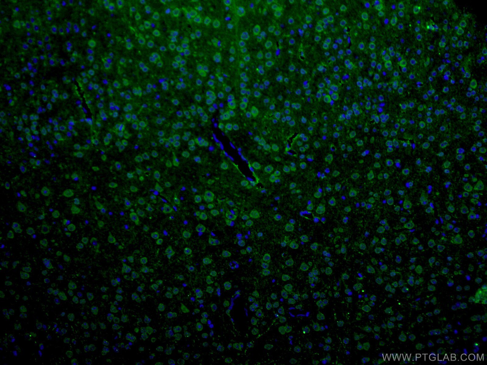 Immunofluorescence (IF) / fluorescent staining of mouse brain tissue using ANK3 Polyclonal antibody (27766-1-AP)