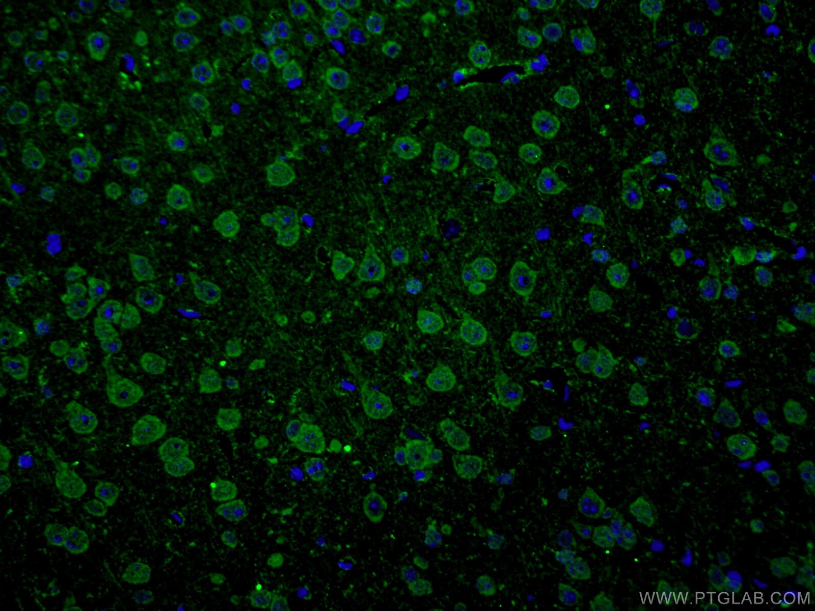 Immunofluorescence (IF) / fluorescent staining of mouse brain tissue using ANK3 Polyclonal antibody (27766-1-AP)