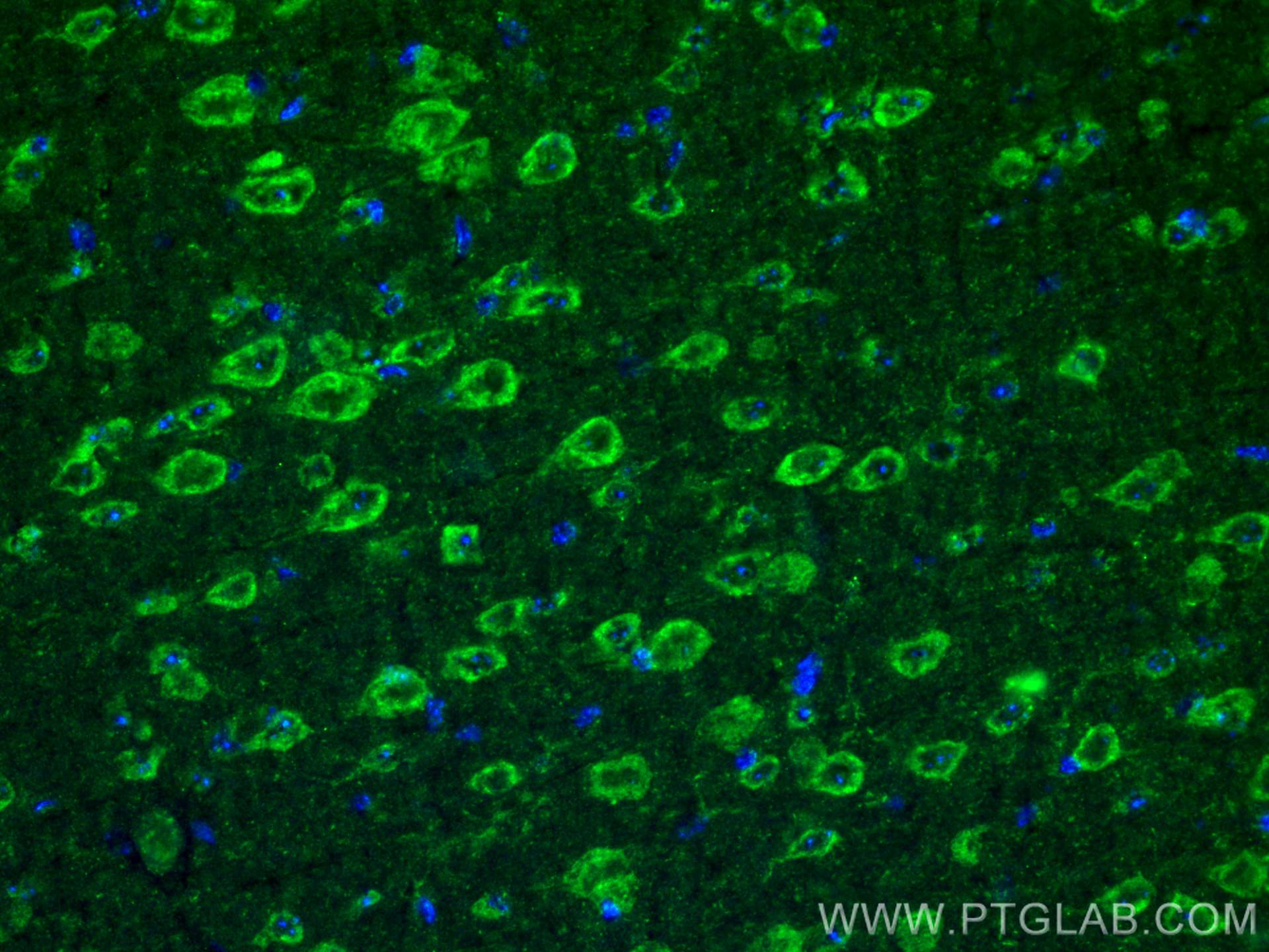 Immunofluorescence (IF) / fluorescent staining of mouse brain tissue using ANK3 Polyclonal antibody (27766-1-AP)