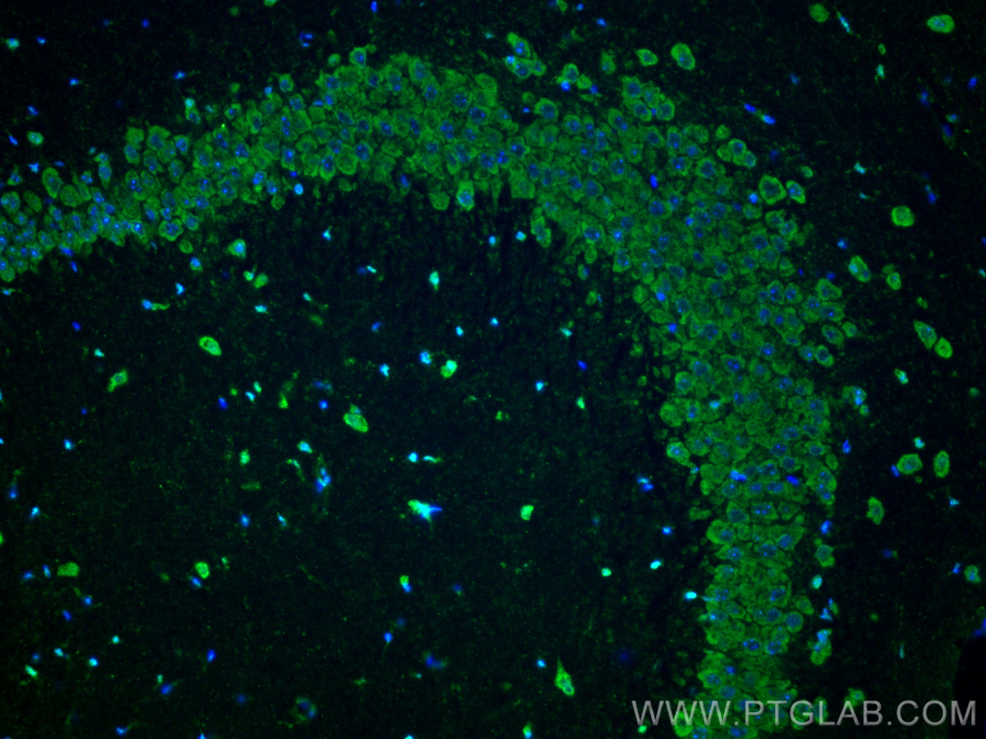 Immunofluorescence (IF) / fluorescent staining of mouse brain tissue using ANK3 Polyclonal antibody (27766-1-AP)