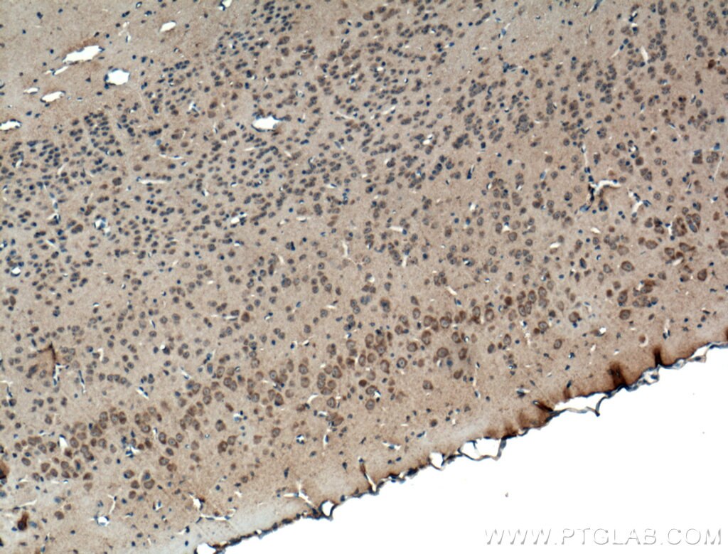 Immunohistochemistry (IHC) staining of mouse brain tissue using ANK3 Polyclonal antibody (27766-1-AP)