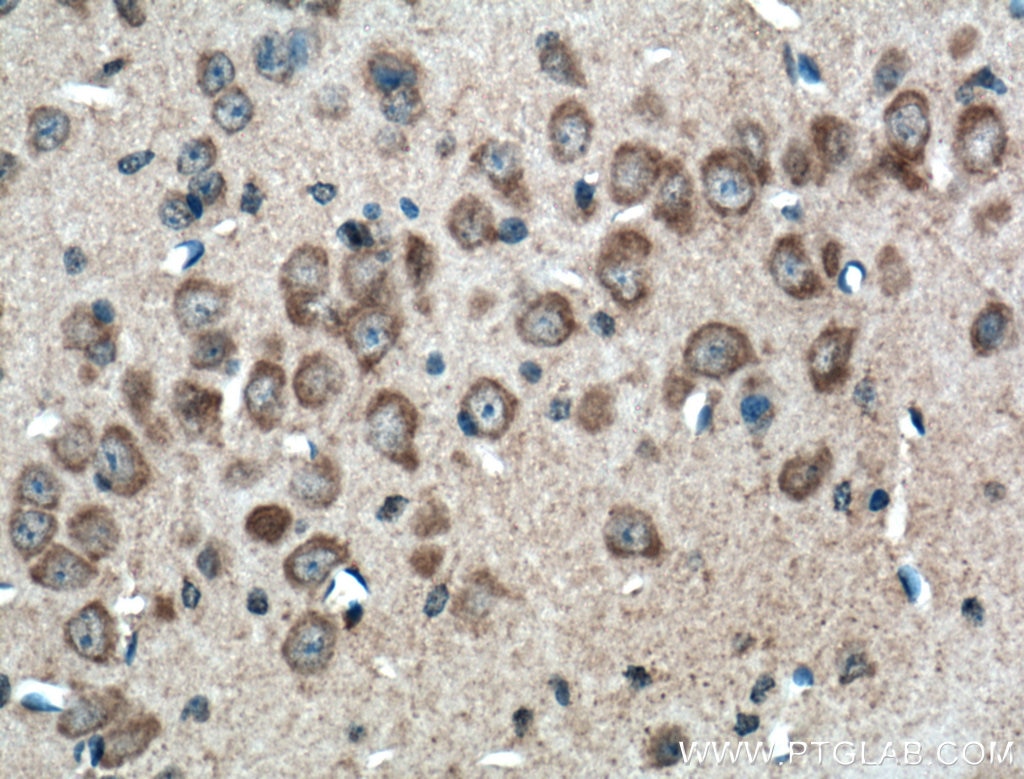 Immunohistochemistry (IHC) staining of mouse brain tissue using ANK3 Polyclonal antibody (27766-1-AP)