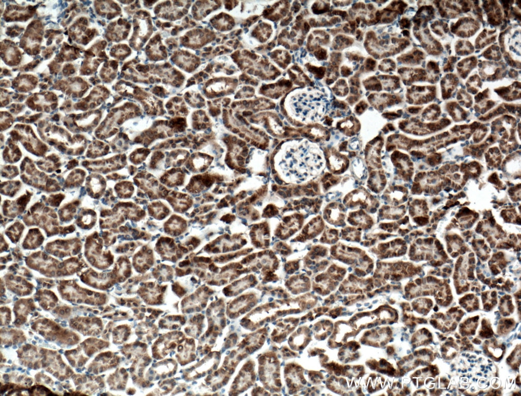 Immunohistochemistry (IHC) staining of mouse kidney tissue using ANK3 Polyclonal antibody (27766-1-AP)