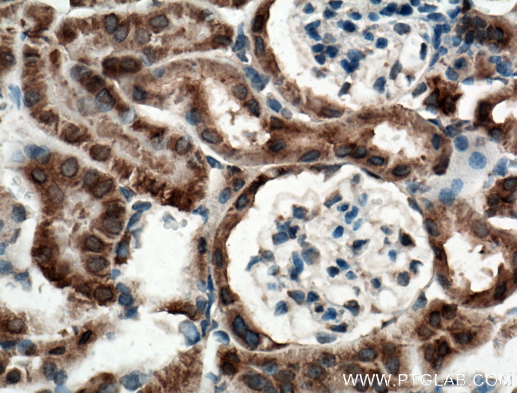 Immunohistochemistry (IHC) staining of mouse kidney tissue using ANK3 Polyclonal antibody (27766-1-AP)