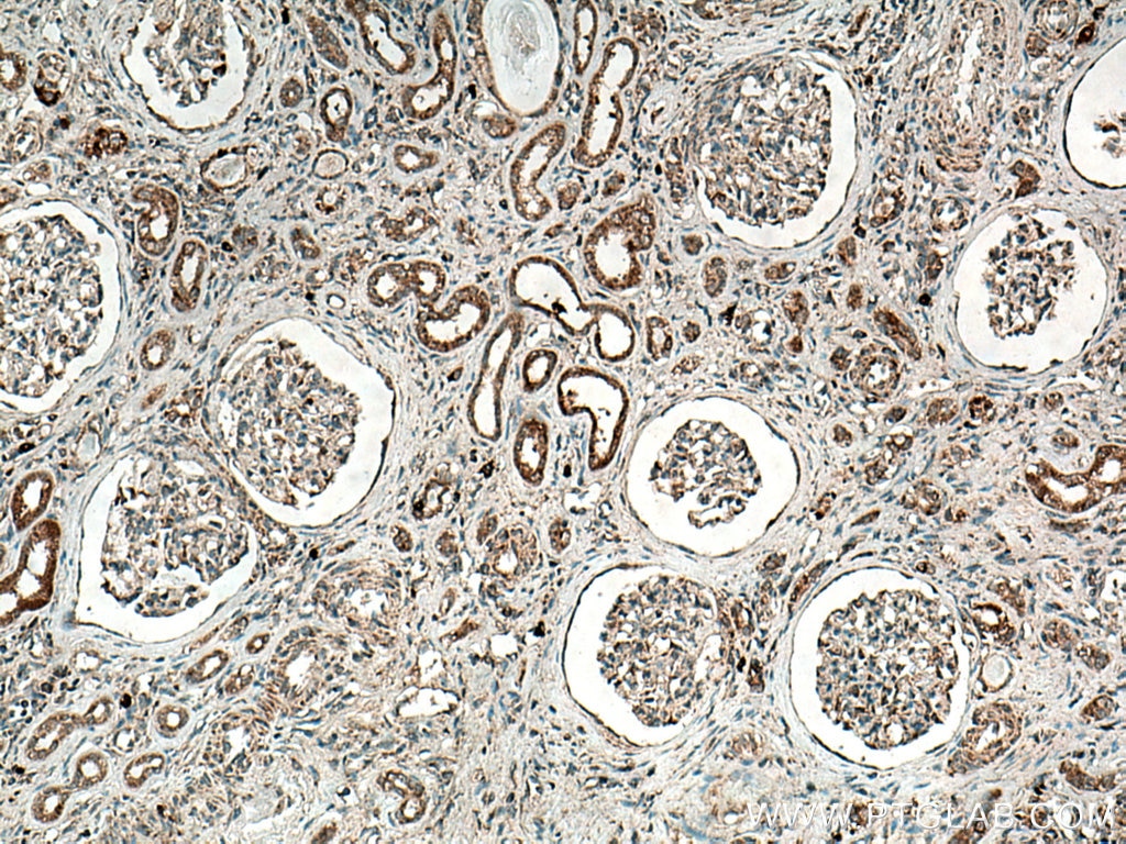 Immunohistochemistry (IHC) staining of human kidney tissue using ANK3 Polyclonal antibody (27766-1-AP)