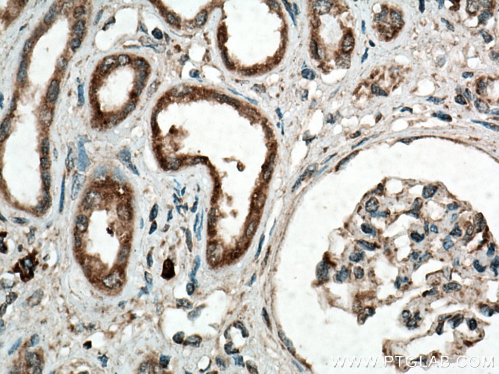 Immunohistochemistry (IHC) staining of human kidney tissue using ANK3 Polyclonal antibody (27766-1-AP)