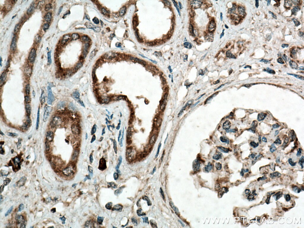 IHC staining of human kidney using 27766-1-AP