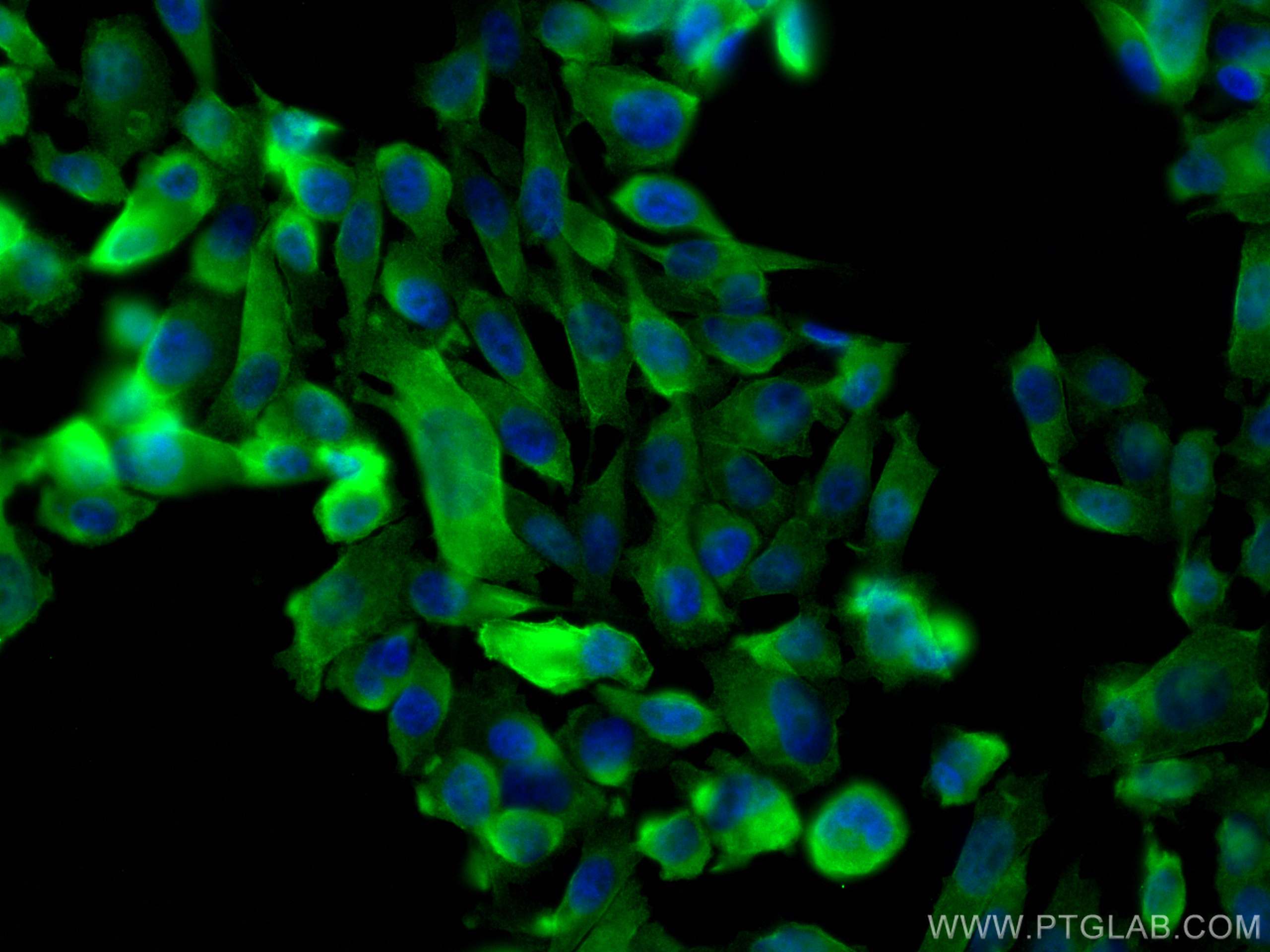 Immunofluorescence (IF) / fluorescent staining of PC-3 cells using ANK3 Polyclonal antibody (27980-1-AP)