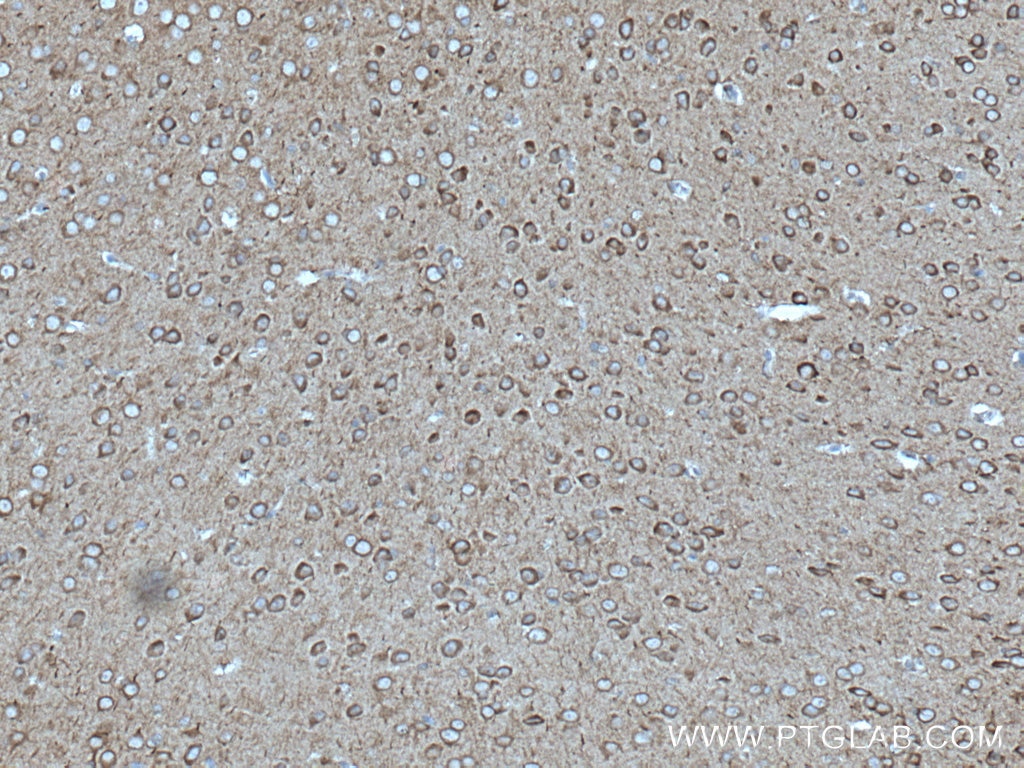 Immunohistochemistry (IHC) staining of mouse brain tissue using ANK3 Polyclonal antibody (27980-1-AP)