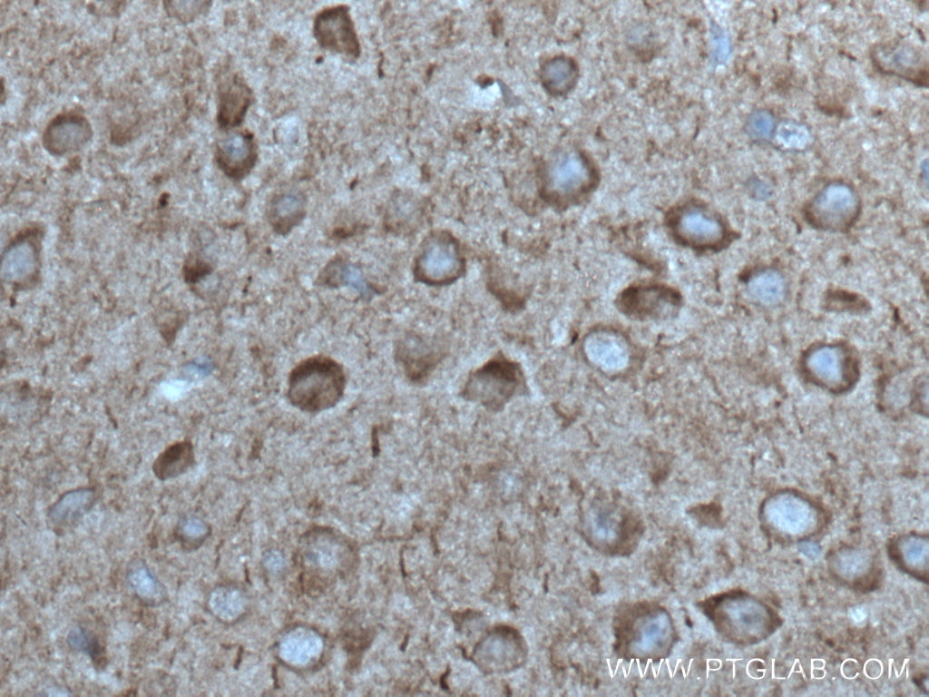 Immunohistochemistry (IHC) staining of mouse brain tissue using ANK3 Polyclonal antibody (27980-1-AP)
