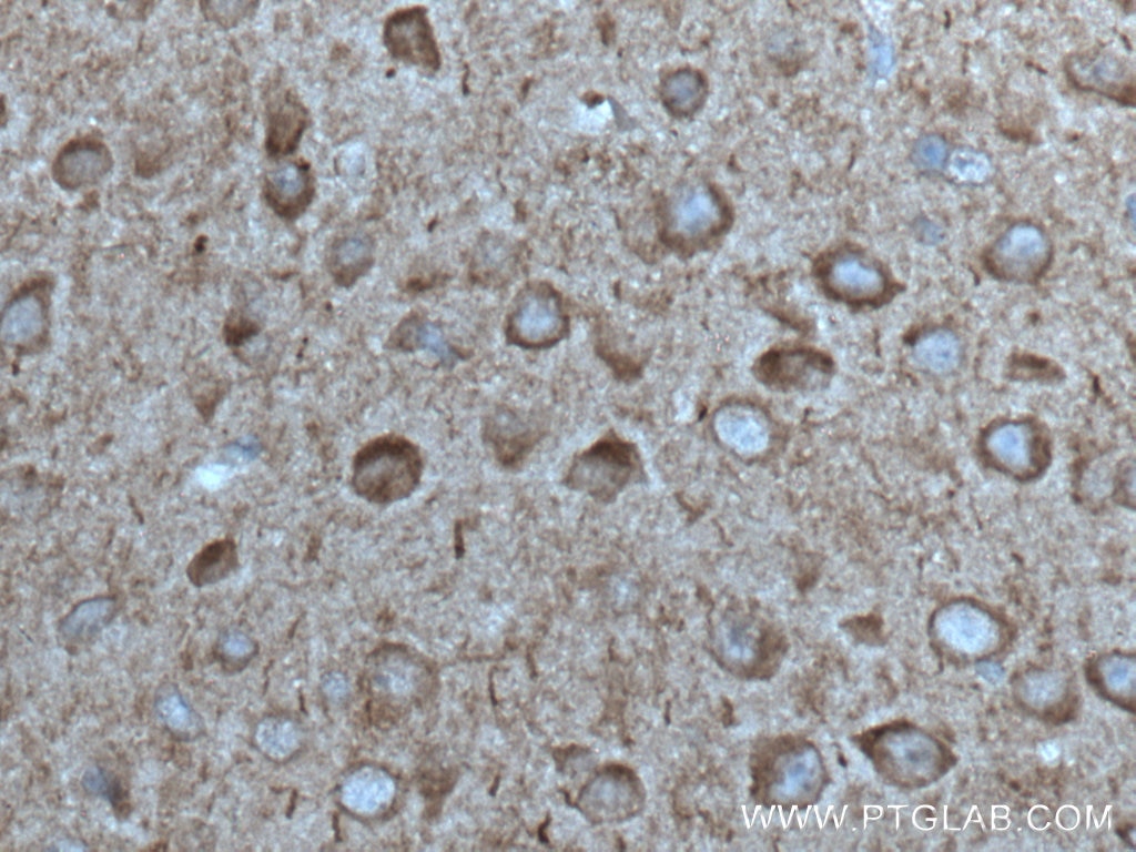 IHC staining of mouse brain using 27980-1-AP