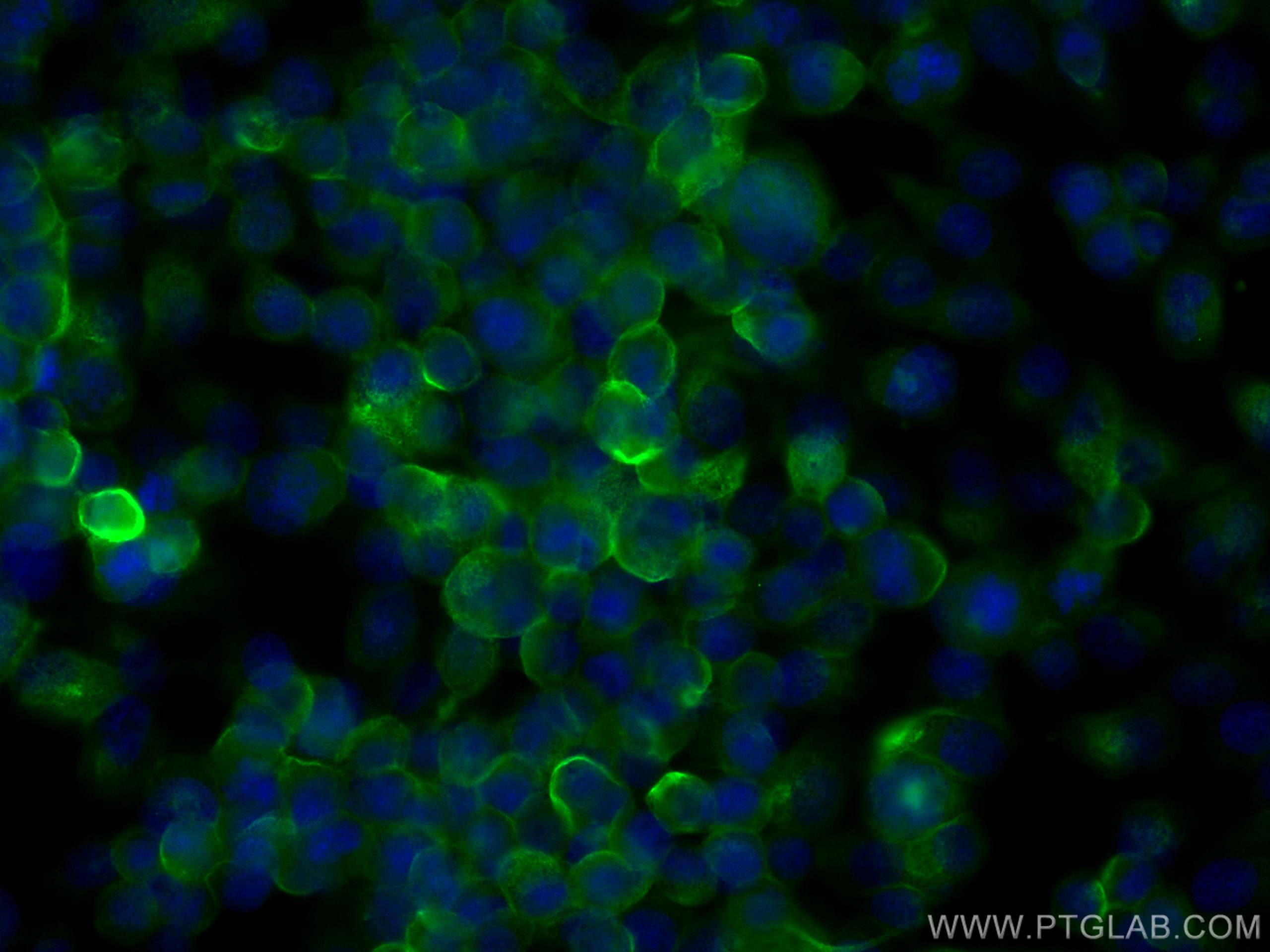 Immunofluorescence (IF) / fluorescent staining of PC-3 cells using CoraLite® Plus 488-conjugated ANK3 Polyclonal anti (CL488-27980)