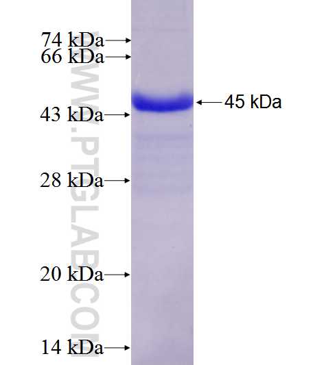 ANK3 fusion protein Ag27635 SDS-PAGE