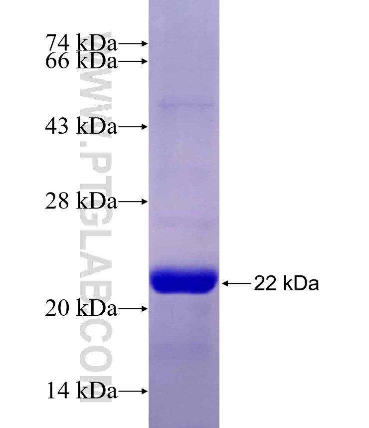 ANK3 fusion protein Ag27675 SDS-PAGE