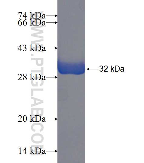 ANKDD1A fusion protein Ag21270 SDS-PAGE